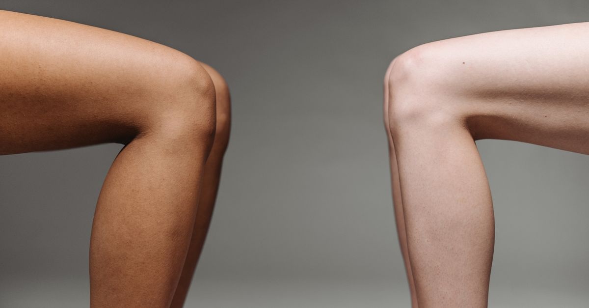 Gambe gonfie e ritenzione idrica: i rimedi più efficaci per sentirti leggera ogni giorno