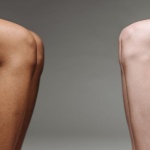 Gambe gonfie e ritenzione idrica: i rimedi più efficaci per sentirti leggera ogni giorno