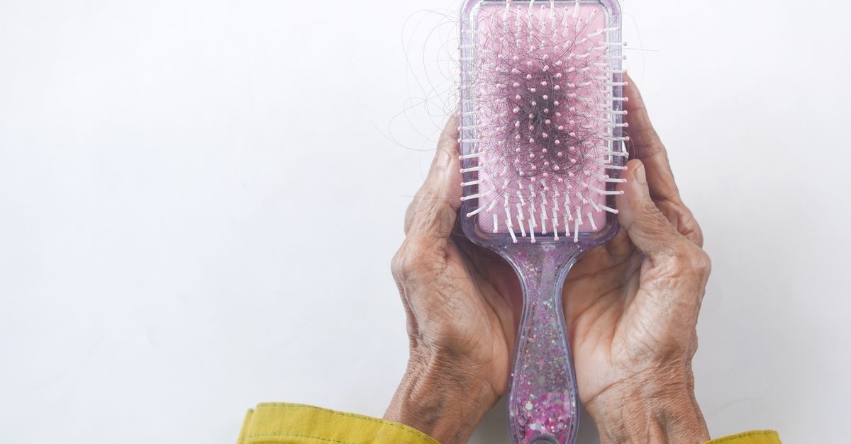Capelli che si assottigliano? Scopri le cause della caduta e i rimedi che funzionano davvero